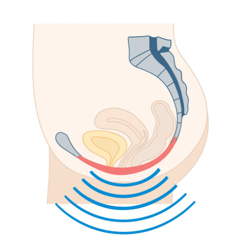 Während der Beckenbodenbehandlung