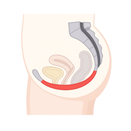 Nach der Beckenbodenbehandlung